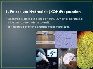 Koh Tablet Method Microbiological diagnosis of microbial diseases | PPTX