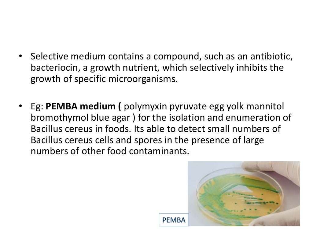 Microbiological examination of food