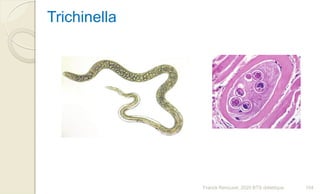Franck Rencurel, 2020 BTS diététique 104
Trichinella
 