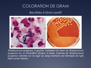 COLORATION DE GRAM
Bactéries à Gram positif
Streptococcus pyogenes. A gauche. Coloration de Gram de Streptococcus
pyogenes sur un échantillon clinique. A droite. Colonies de Streptococcus
pyogenes cultivées sur du agar au sang montrant une hémolyse de type
beta (zones claires).
 