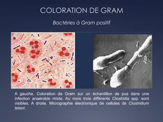 COLORATION DE GRAM
Bactéries à Gram positif
A gauche. Coloration de Gram sur un échantillon de pus dans une
infection anaérobie mixte. Au mois trois différents Clostridia spp. sont
visibles. A droite. Micrographie électronique de cellules de Clostridium
tetani.
 