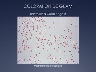 COLORATION DE GRAM
Bactéries à Gram négatif
Pseudomonas aeruginosa
 