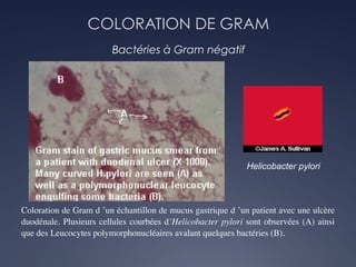COLORATION DE GRAM
Bactéries à Gram négatif
Helicobacter pylori
Coloration de Gram d ’un échantillon de mucus gastrique d ’un patient avec une ulcère
duodénale. Plusieurs cellules courbées d’Helicobacter pylori sont observées (A) ainsi
que des Leucocytes polymorphonucléaires avalant quelques bactéries (B).
 