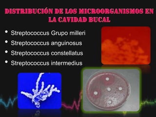 • Streptococcus Grupo milleri
• Streptococcus anguinosus
• Streptococcus constellatus
• Streptococcus intermedius
 