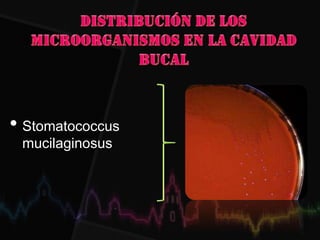 • Stomatococcus
mucilaginosus
 