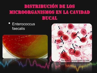 • Enterococcus
faecalis
 