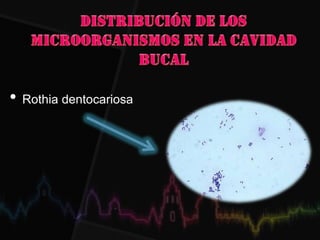 • Rothia dentocariosa
 