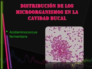 • Acidaminococcus
fermentans
 