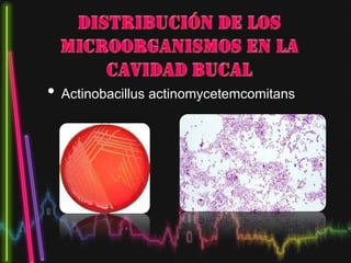• Actinobacillus actinomycetemcomitans
 