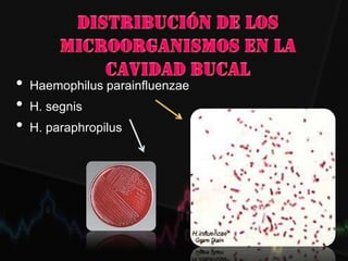 • Haemophilus parainfluenzae
• H. segnis
• H. paraphropilus
 