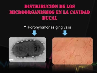 • Porphyromonas gingivalis
 