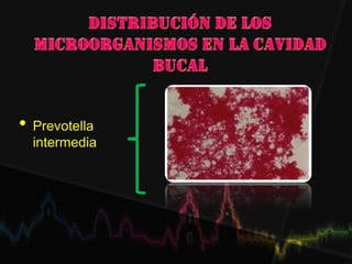 • Prevotella
intermedia
 
