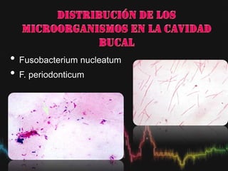 • Fusobacterium nucleatum
• F. periodonticum
 