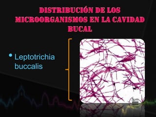 •Leptotrichia
buccalis
 