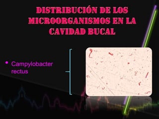 • Campylobacter
rectus
 