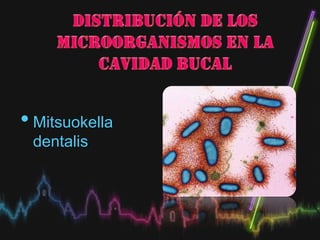 •Mitsuokella
dentalis
 