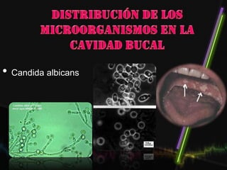 • Candida albicans
 