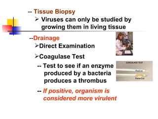 -- Drainage --  If positive, organism is considered more virulent --  Tissue Biopsy Viruses can only be studied by growing them in living tissue Direct Examination Coagulase Test -- Test to see if an enzyme produced by a bacteria produces a thrombus 