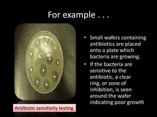 For example . . .

                                 • Small wafers containing
                                   antibiotics are placed
                                   onto a plate which
                                   bacteria are growing.
                                 • If the bacteria are
                                   sensitive to the
                                   antibiotic, a clear
                                   ring, or zone of
                                   inhibition, is seen
                                   around the wafer
                                   indicating poor growth
Antibiotic sensitivity testing
 
