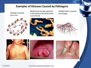 5/18/2018 13www.drjayeshpatidar.blogspot.com
 