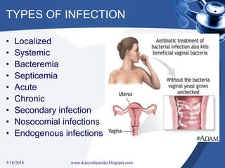 TYPES OF INFECTION
• Localized
• Systemic
• Bacteremia
• Septicemia
• Acute
• Chronic
• Secondary infection
• Nosocomial infections
• Endogenous infections
5/18/2018 15www.drjayeshpatidar.blogspot.com
 