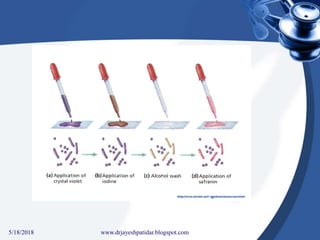 5/18/2018 27www.drjayeshpatidar.blogspot.com
 