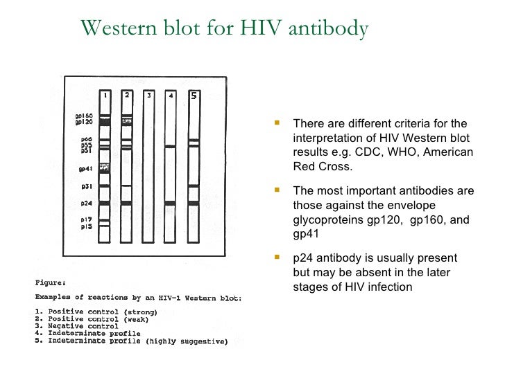 western blot hiv western blot hiv
