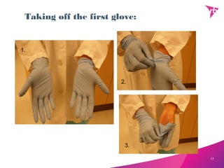 Taking off the first glove:


1.




                        2.




                         3.

                               17
 