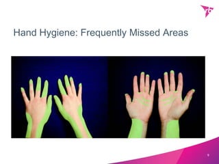 Hand Hygiene: Frequently Missed Areas




                                        9
 