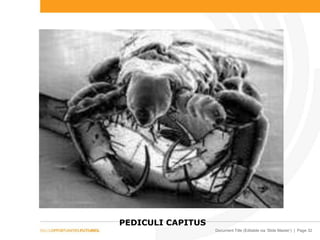 Document Title (Editable via ‘Slide Master’) | Page 32
PEDICULI CAPITUS
 