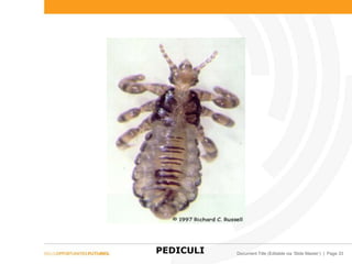 Document Title (Editable via ‘Slide Master’) | Page 33PEDICULI
 