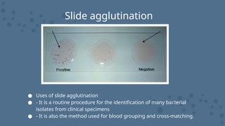 Slide agglutination
● Uses of slide agglutination
● - It is a routine procedure for the identification of many bacterial
isolates from clinical specimens
● - It is also the method used for blood grouping and cross-matching.
 