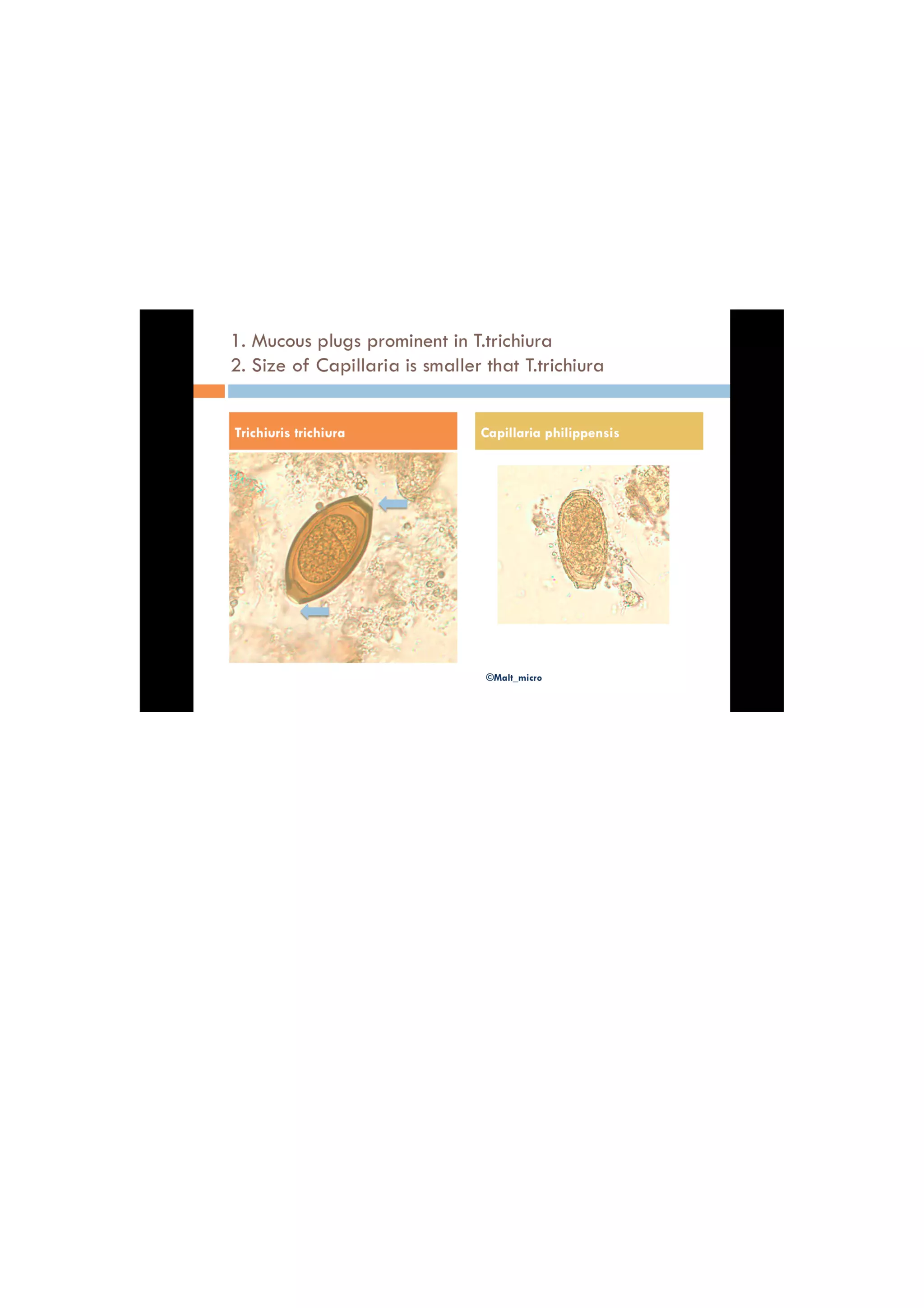 Microbiology – a glimpse for pgmee – important questions and points by malathi m