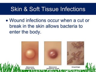 Microbiology &Antibiotics