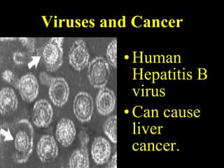 Viruses and Cancer Human Hepatitis B virus Can cause liver cancer. 