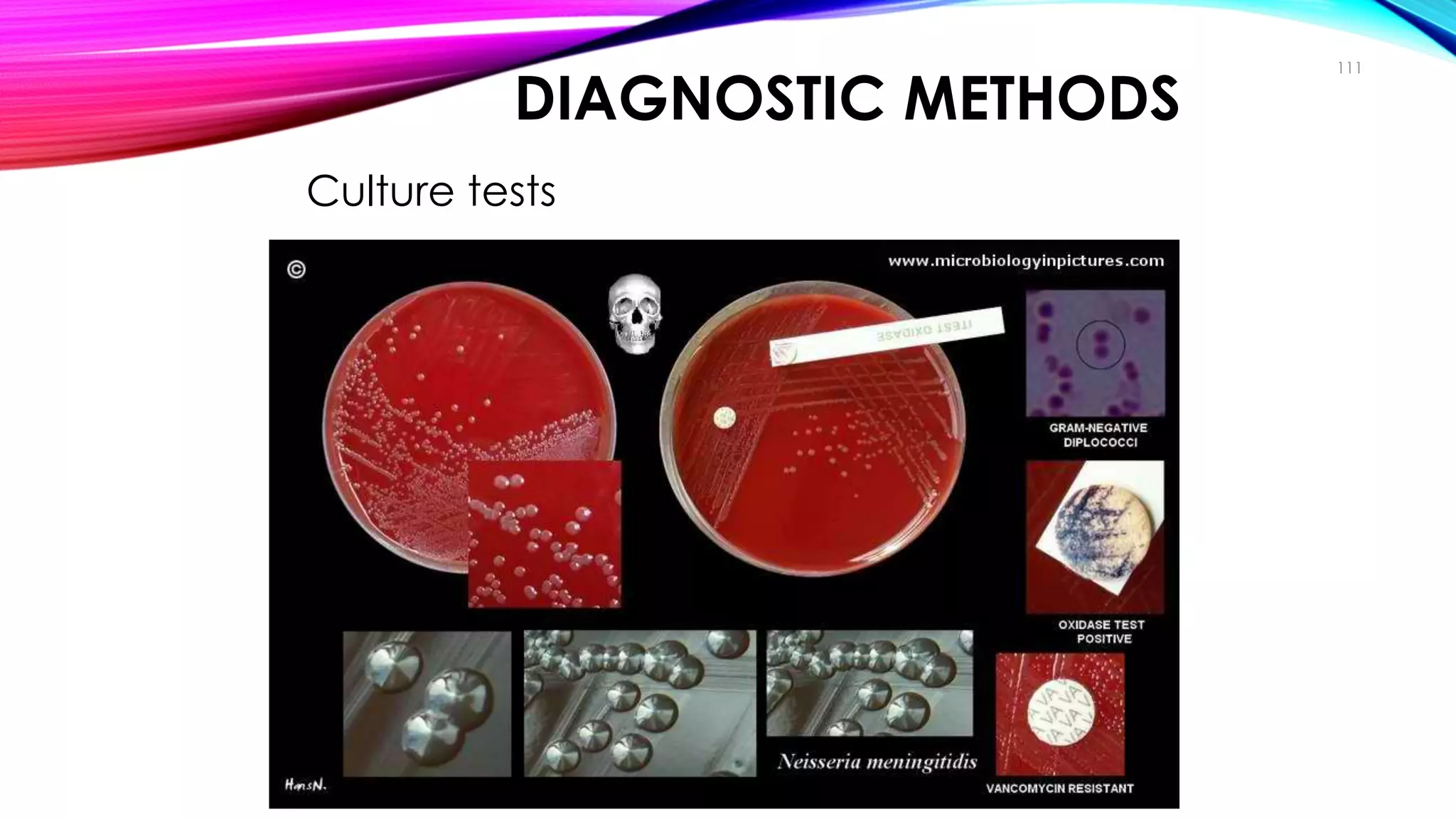 DIAGNOSTIC METHODS
• Culture tests
111
Diagnosis
 