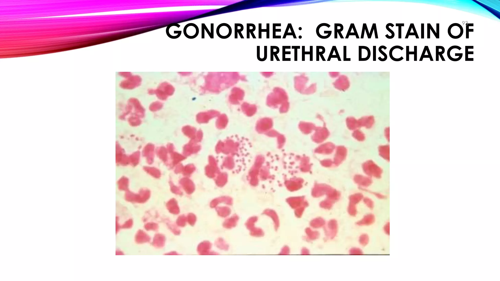 GONORRHEA: GRAM STAIN OF
URETHRAL DISCHARGE
93
Pathogenesis
 