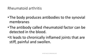Rheumatoid arthritis
•The body produces antibodies to the synovial
membranes
•The antibody called rheumatoid factor can be
detected in the blood.
•It leads to chronically inflamed joints that are
stiff, painful and swollen.
INTRO BLOCK IMMUNOLOGY
 