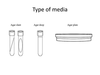 Type of media
 
