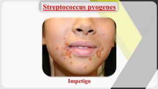 Intego Infection Microbiology (lab diagnosis result of fungal and bacterial skin ...