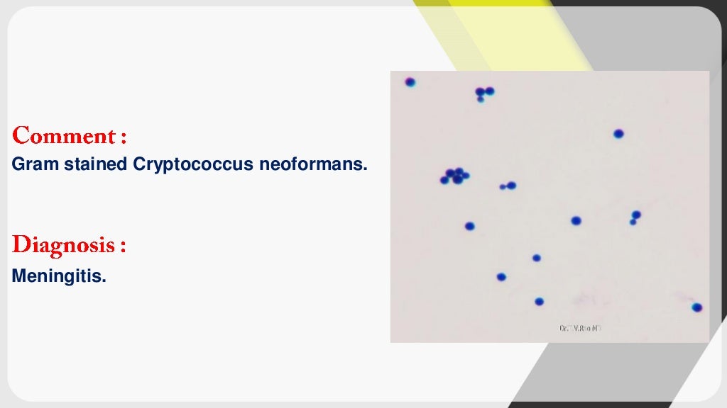 Microbiology (laboratory examination of csf)