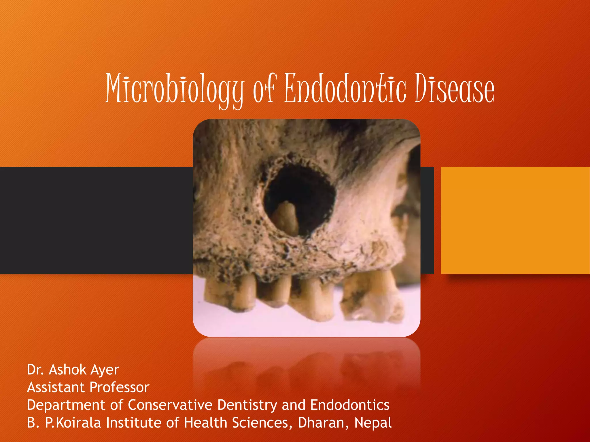 Microbiology of endodontic disease | PPTX