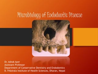 Microbiology of Endodontic Disease
Dr. Ashok Ayer
Assistant Professor
Department of Conservative Dentistry and Endodontics
B. P.Koirala Institute of Health Sciences, Dharan, Nepal
 