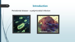 Microbiology of periodontal diseases | PPTX