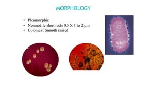 Microbiology of periodontal diseases | PPTX