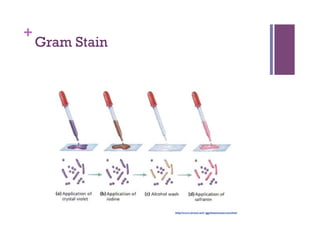 +
    Gram Stain
 