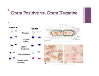 +
    Gram Positive vs. Gram Negative
 