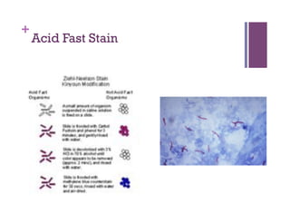 +
    Acid Fast Stain
 