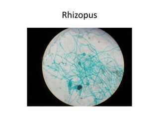 Rhizopus 