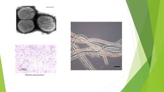Schaalia Radingae Bacterial morphology and classification.pptx